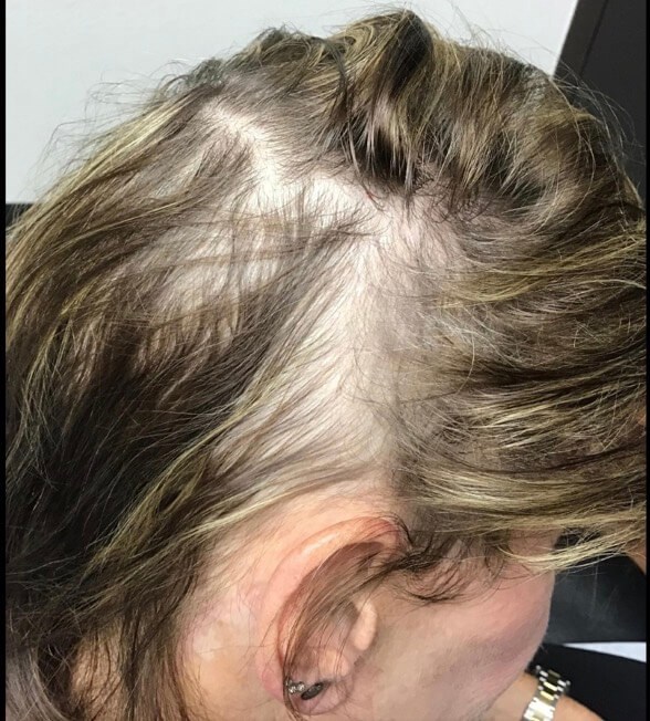 Before Image