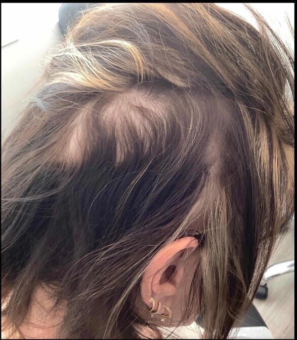 After Image