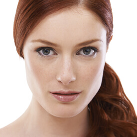Rosacea 